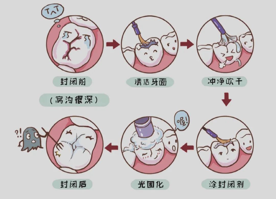 一起來聊聊這10個關於孩子的口腔問題|七巧板育兒堂 親子 第23張