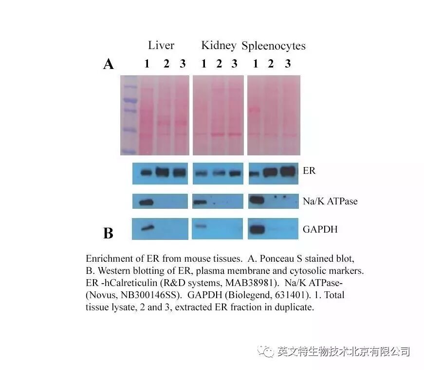 【新品抢先看】细胞器互作，蛋白转运研究样品分离新工具！