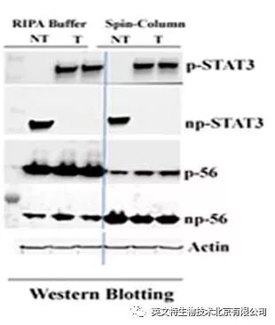磷酸化蛋白 WB 做不好？原因竟有可能是因为......