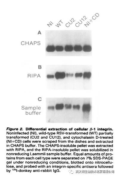 磷酸化蛋白 WB 做不好？原因竟有可能是因为......