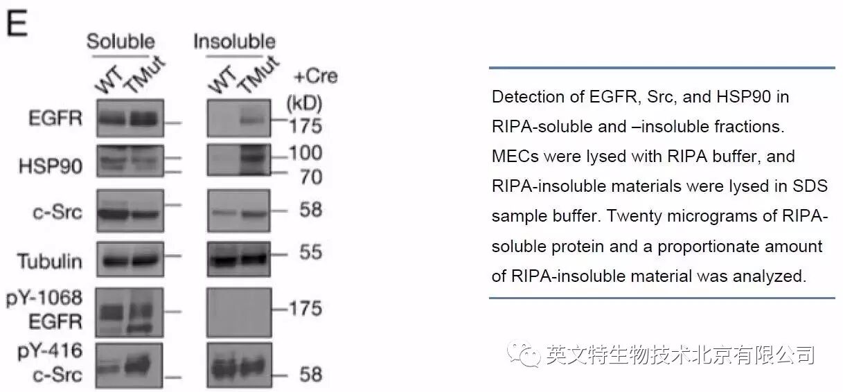 磷酸化蛋白 WB 做不好？原因竟有可能是因为......