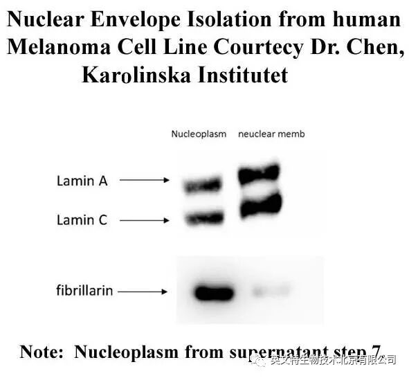 目的蛋白是核蛋白，我该拿它怎么办？