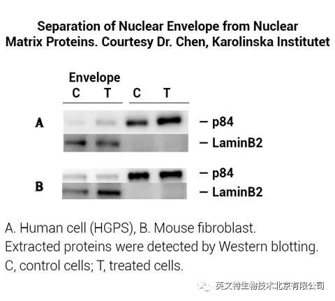 目的蛋白是核蛋白，我该拿它怎么办？