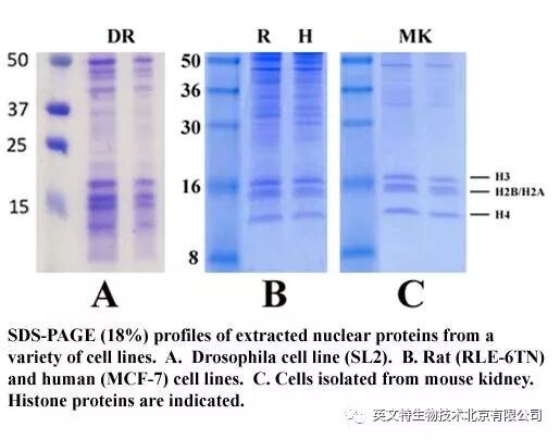 目的蛋白是核蛋白，我该拿它怎么办？