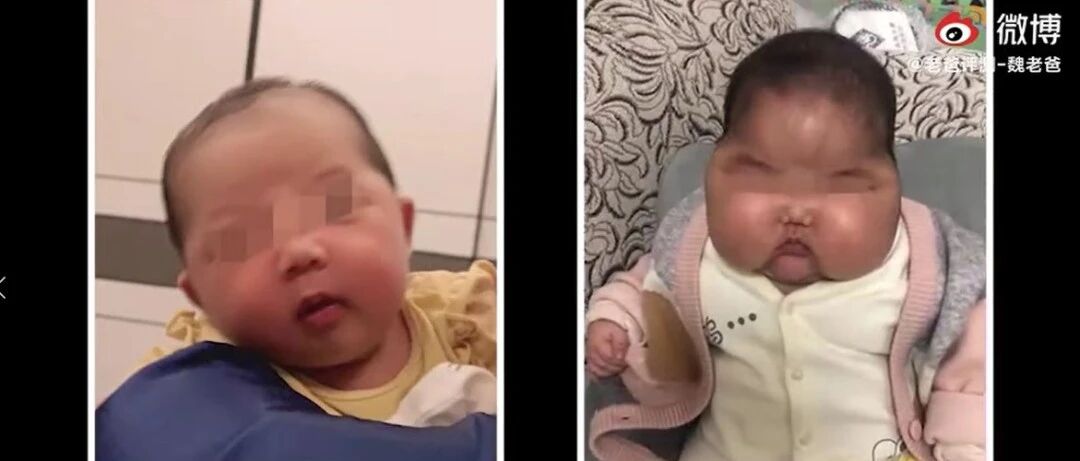 江苏“大头娃娃”事件引众怒，但这只是冰山一角