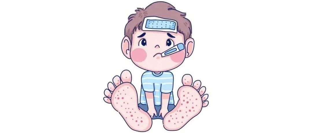 川崎病的免疫细胞“地图”