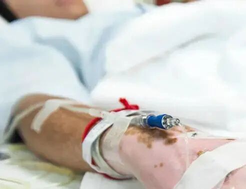 为什么输血不能用小针在手术室内为什么要穿刺一个和在病房内颜色不同的外周静脉留置针？_https://www.jmylbn.com_新闻资讯_第3张