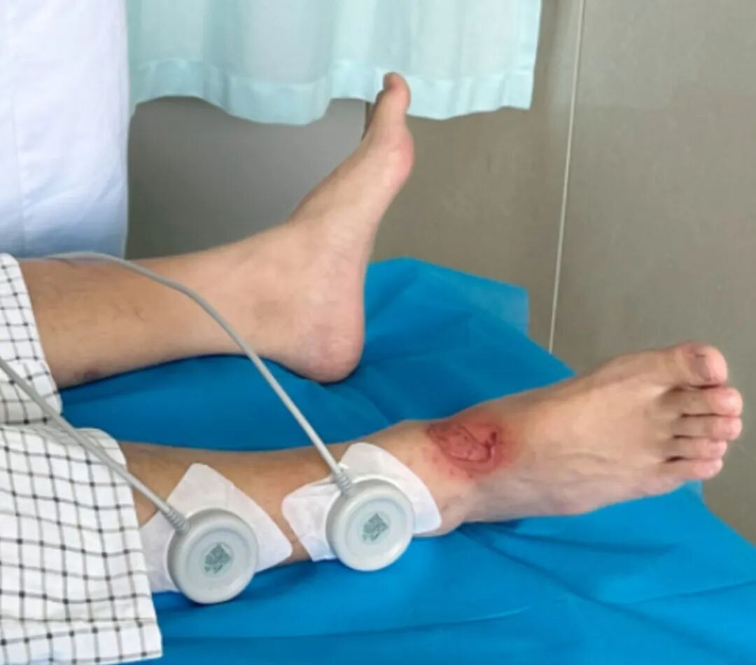 什么皮给药治【健康科普】新型给药方式—超声药物透入治疗_https://www.jmylbn.com_新闻资讯_第4张