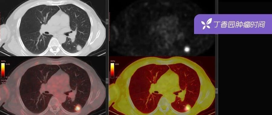 2024-02-18药事资讯
