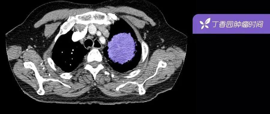 2022-10-04药事资讯