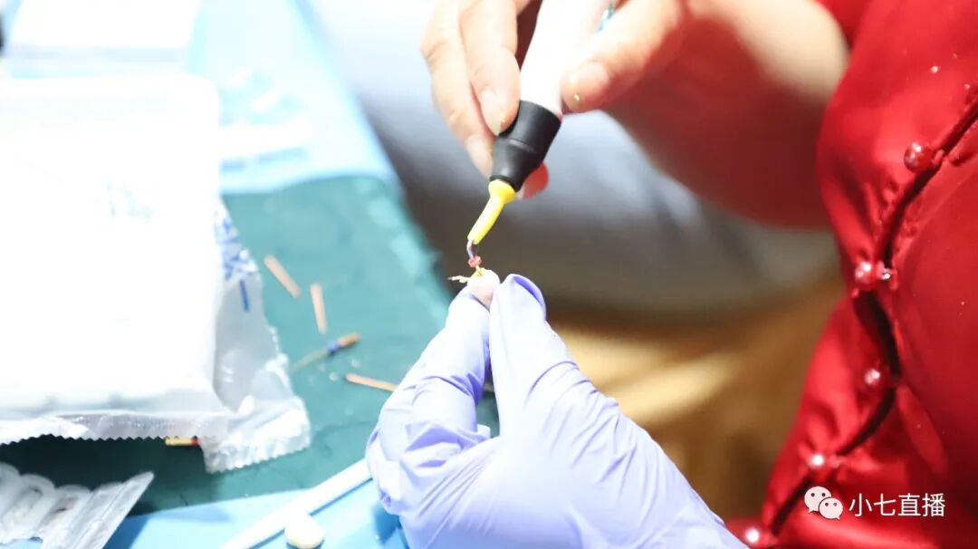 根充需要哪些器械【根管治疗】根管治疗操作规范_https://www.jmylbn.com_新闻资讯_第12张