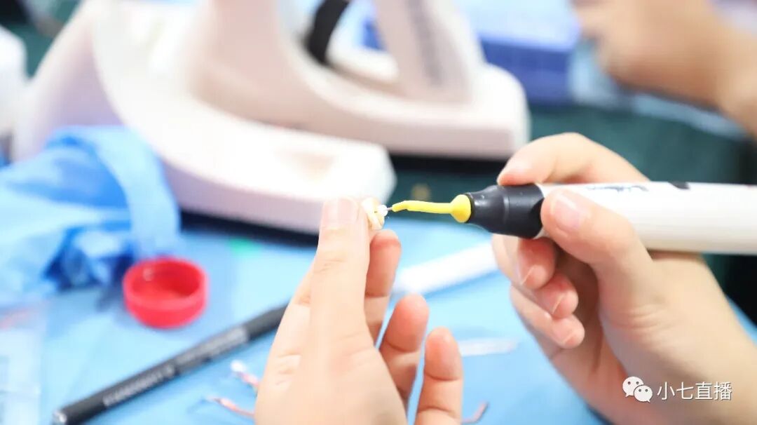 根充需要哪些器械【根管治疗】根管治疗操作规范_https://www.jmylbn.com_新闻资讯_第11张