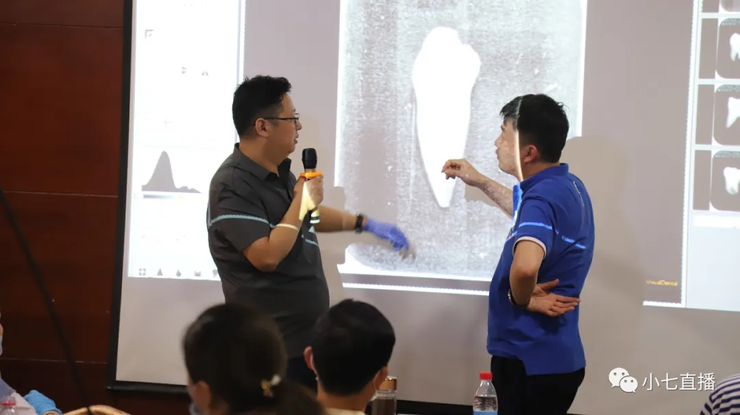 根充需要哪些器械【根管治疗】根管治疗操作规范_新闻资讯_第2张_活检穿刺产品网 根充需要哪些器械【根管治疗】根管治疗操作规范_https://www.jmylbn.com_新闻资讯_第2张