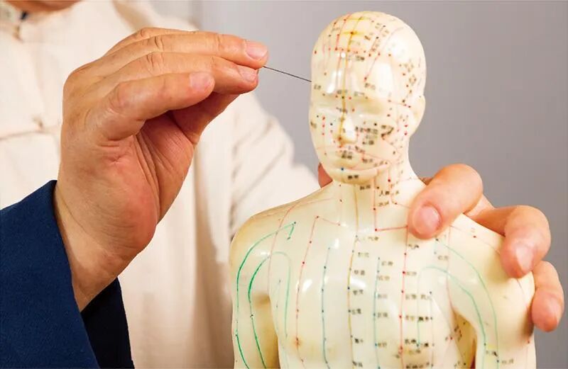 导什么针什么作用【医学科普】针灸——小小银针发挥大作用_https://www.jmylbn.com_新闻资讯_第12张