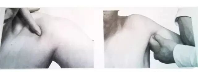 外展枕怎么使用总结的很全的针刀治疗要点，学针刀的人不容错过_https://www.jmylbn.com_新闻资讯_第23张