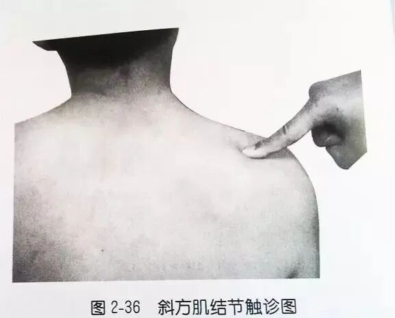 外展枕怎么使用总结的很全的针刀治疗要点，学针刀的人不容错过_https://www.jmylbn.com_新闻资讯_第15张