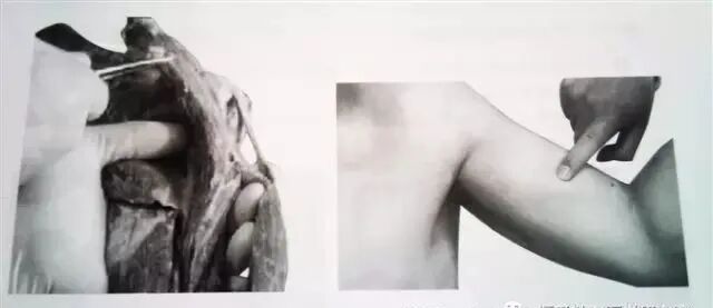 外展枕怎么使用总结的很全的针刀治疗要点，学针刀的人不容错过_https://www.jmylbn.com_新闻资讯_第24张