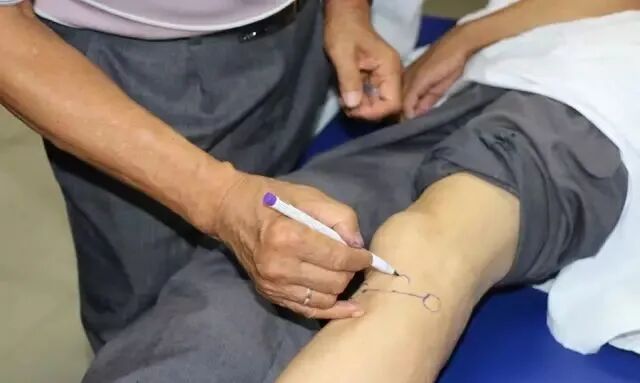 外展枕怎么使用总结的很全的针刀治疗要点，学针刀的人不容错过_https://www.jmylbn.com_新闻资讯_第3张