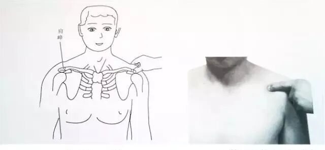 外展枕怎么使用总结的很全的针刀治疗要点，学针刀的人不容错过_https://www.jmylbn.com_新闻资讯_第19张