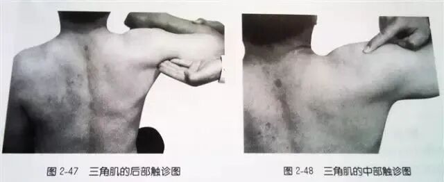 外展枕怎么使用总结的很全的针刀治疗要点，学针刀的人不容错过_https://www.jmylbn.com_新闻资讯_第22张