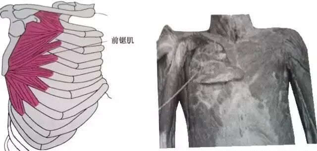 外展枕怎么使用总结的很全的针刀治疗要点，学针刀的人不容错过_https://www.jmylbn.com_新闻资讯_第46张