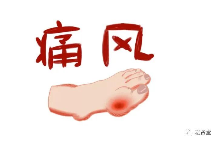 aed有什么牌子痛风药的十大名牌有哪些 痛风药哪个牌子好 解决痛风的保健品非常值得入-上海聚慕医疗器械有限公司