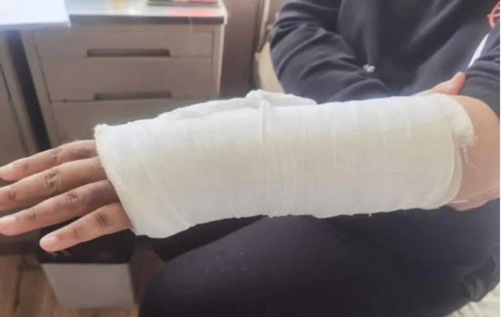 AED怎么自检手腕摔伤后自检方法及诊疗释疑_https://www.jmylbn.com_新闻资讯_第16张