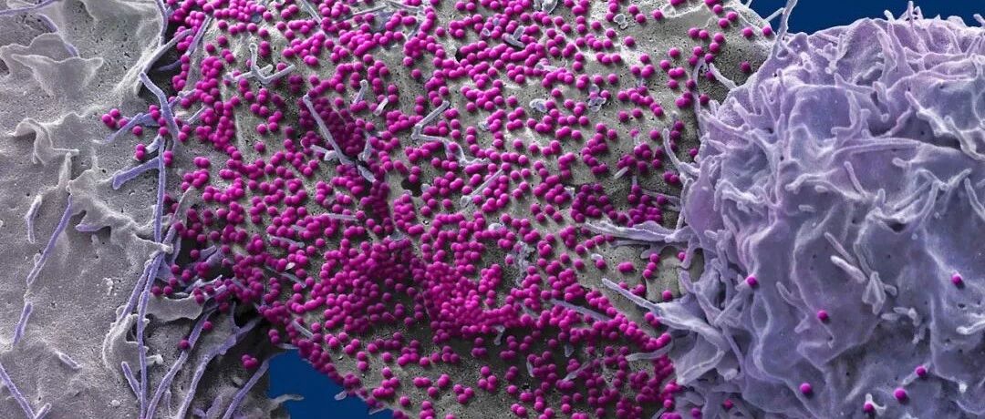 停药66周未检出HIV，艾滋病能通过药物治愈了？专家：孤例，仍待观察