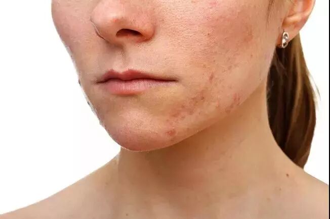 角质产品是什么意思_角质护肤品_去角质的产品哪款好用