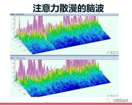 全球顶尖最权威的脑波仪大脑检测 七田惠全脑 微信公众号文章阅读 Wemp