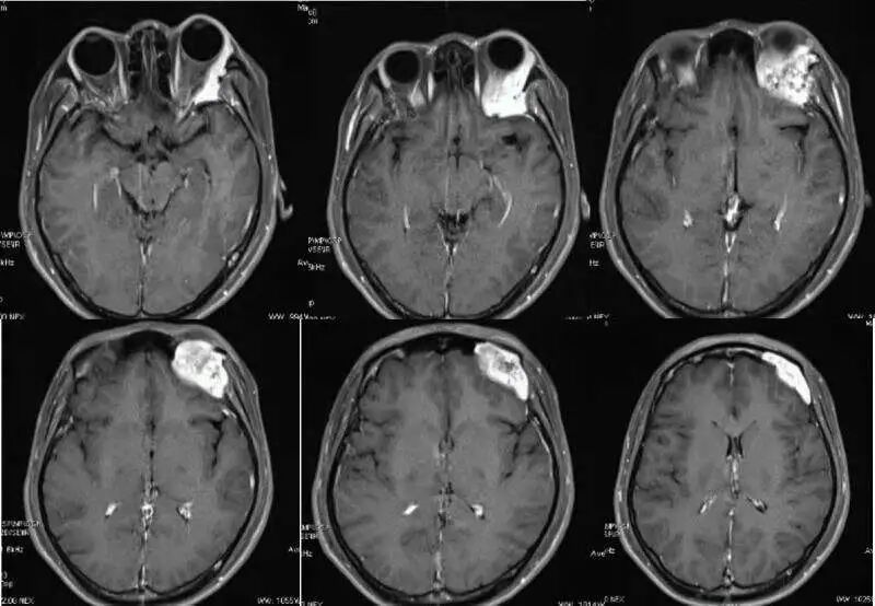 为什么牙医不用开口器5岁女童拔牙大出血，牙医遇到这种情况如何紧急处理？_https://www.jmylbn.com_新闻资讯_第3张