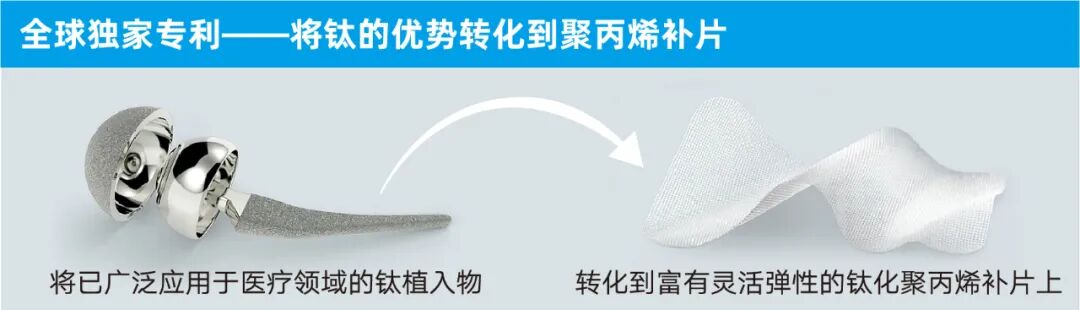 疝补片有什么品牌产品丨带你了解疝补片_https://www.jmylbn.com_新闻资讯_第3张