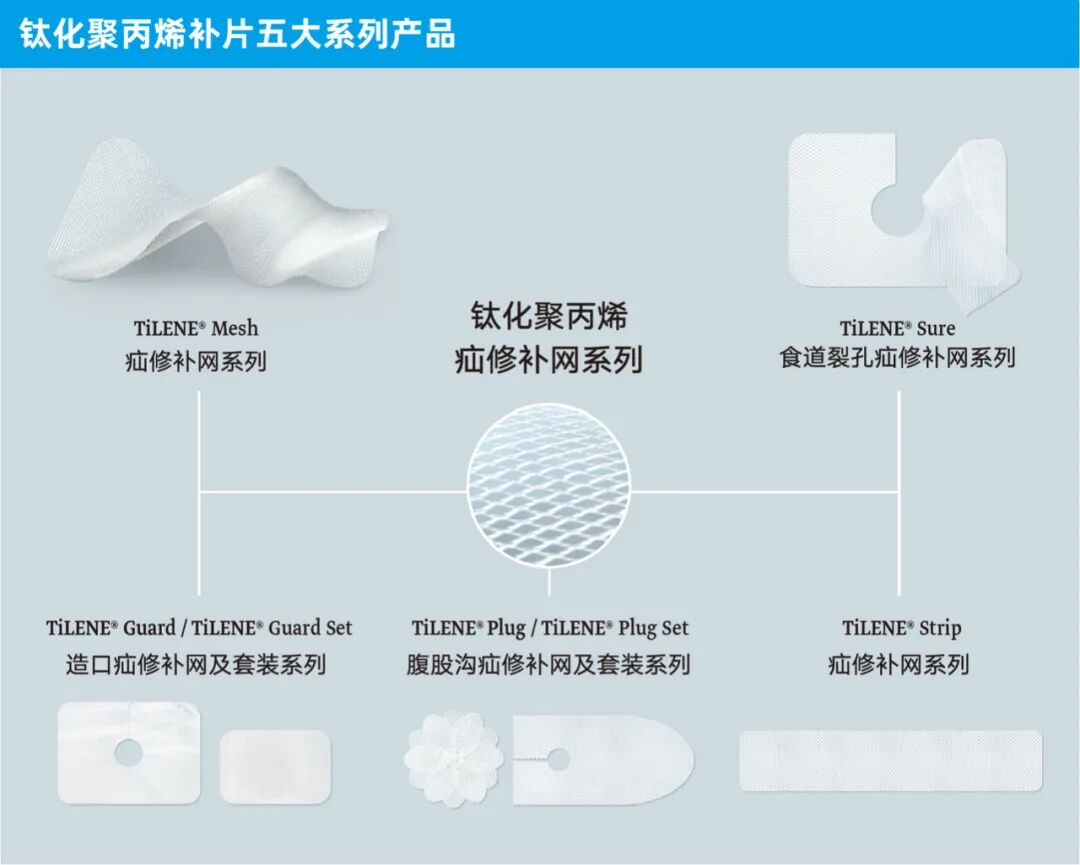 疝补片有什么品牌产品丨带你了解疝补片_https://www.jmylbn.com_新闻资讯_第5张