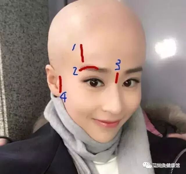 产后严重脱发的简单调理方法