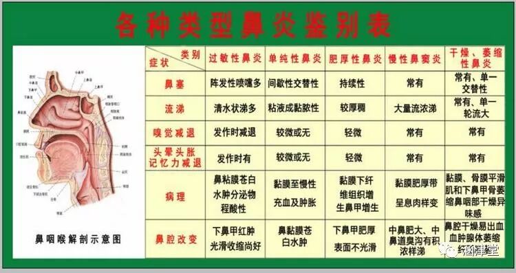 中医针灸治疗鼻炎---神奇的银针18  自由微信 FreeWeChat