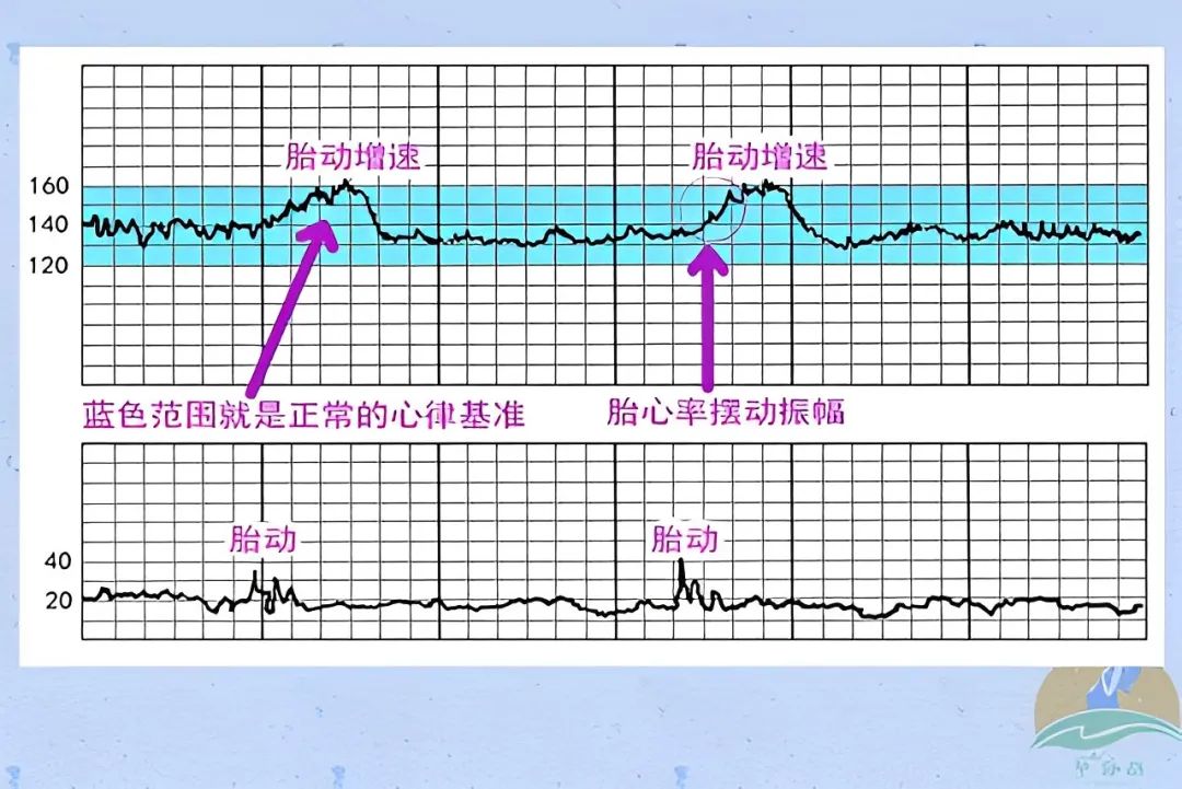 胎心率能分辨男女吗？10个男孩9个测出来低于140次/分？