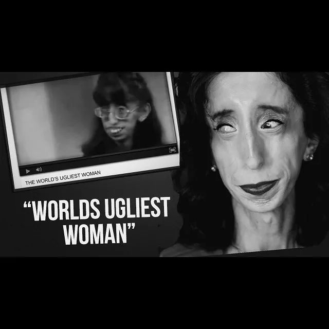 她是"世界上最丑的女人",17岁一丑成名,400万人