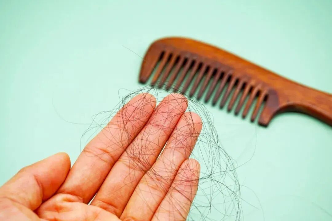 一到秋天脱发更严重了？教你如何有效应对！