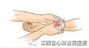 止血器怎么止血科普：桡动脉压迫止血器的使用注意事项_https://www.jmylbn.com_新闻资讯_第5张