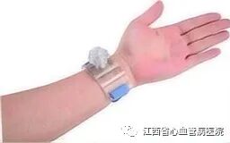 止血器怎么止血科普：桡动脉压迫止血器的使用注意事项_https://www.jmylbn.com_新闻资讯_第2张