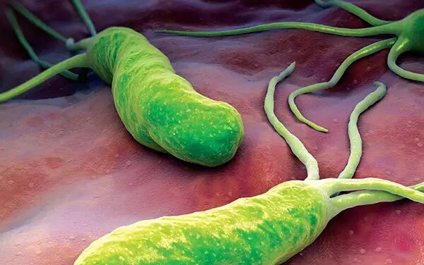 得了幽门螺旋杆菌就是宣判胃癌别自己吓自己了