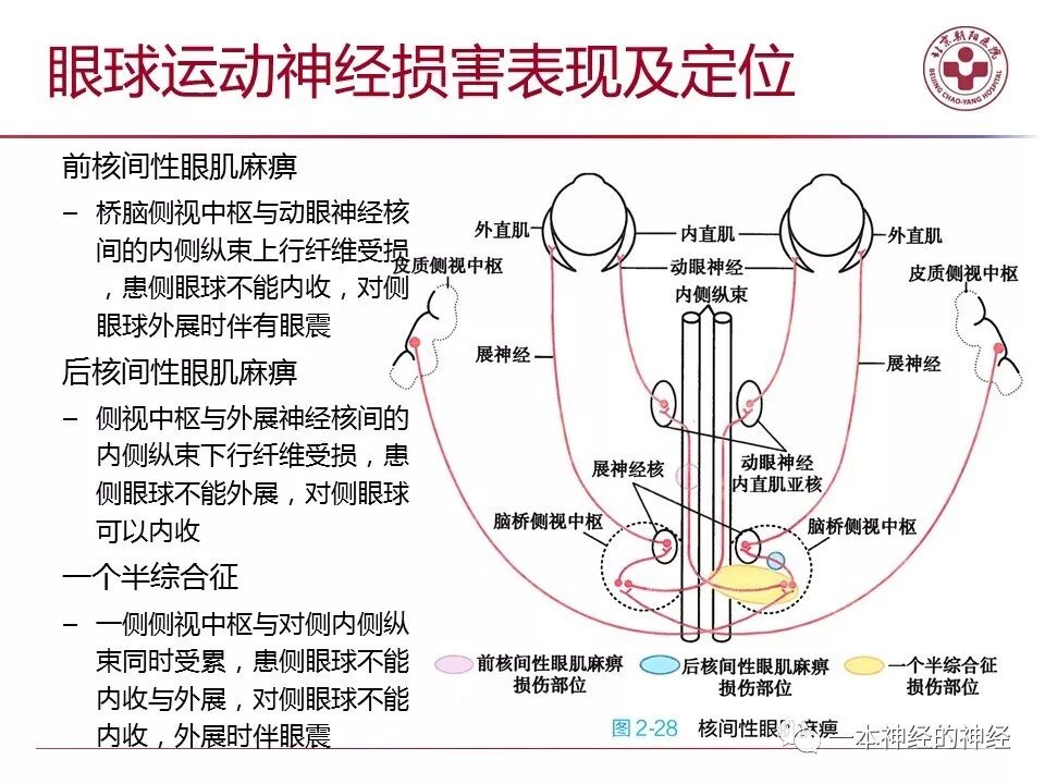 外展枕怎么使用中枢神经系统解剖定位诊断【大全】_https://www.jmylbn.com_新闻资讯_第64张