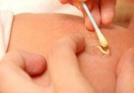 为什么剪脐带要先夹住剪脐带时，为何宝宝哇哇大哭，妈妈却没感觉？医生不小心说出实话_https://www.jmylbn.com_新闻资讯_第10张