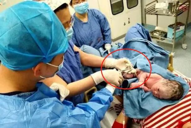 为什么剪脐带要先夹住剪脐带时，为何宝宝哇哇大哭，妈妈却没感觉？医生不小心说出实话_https://www.jmylbn.com_新闻资讯_第3张