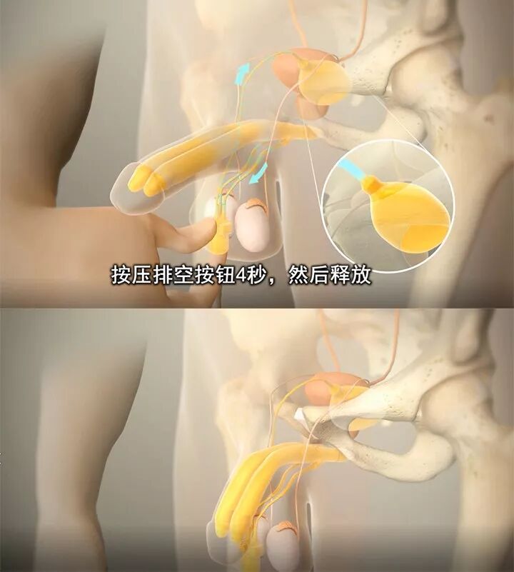 又软又短怎么办?这个神器让你随心所欲,屹立不倒