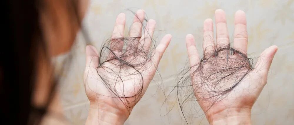 剪短发，能让头发少掉点吗？