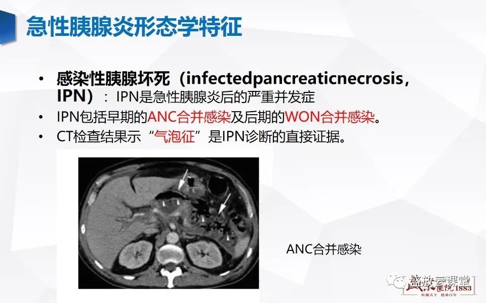 诊断思路胰腺炎影像表现