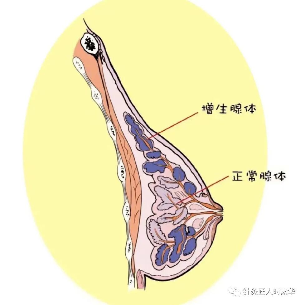 乳腺腺体硬图片