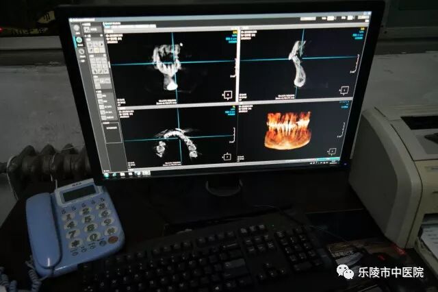 卡瓦口腔怎么购买德国卡瓦口腔CT_https://www.jmylbn.com_新闻资讯_第13张