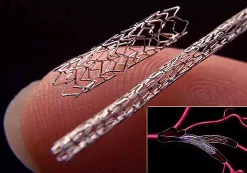 冠状动脉支架,是心脏介入手术中常用的医疗器械,具有疏通动脉血管的